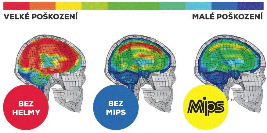 porovnání poškození hlavy bez helmy, s helmou a s technologií MIPS
